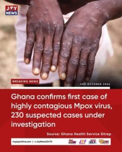 Mpox Outbreak